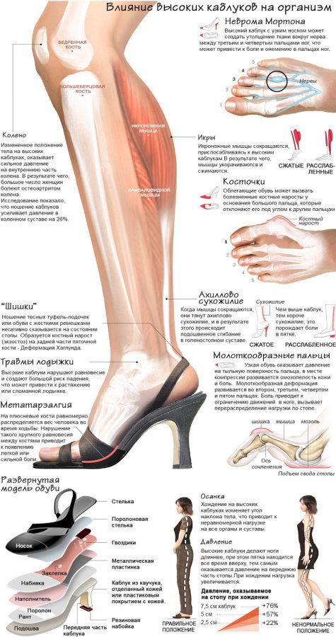 High-heeled shoes and our health