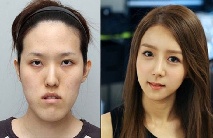 Plastic surgery before and after photos