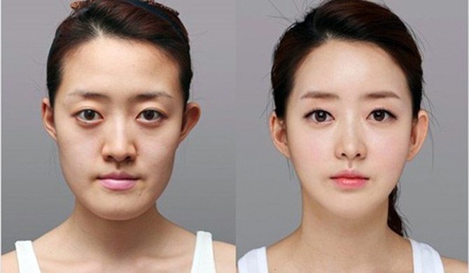 Plastic surgery before and after photos