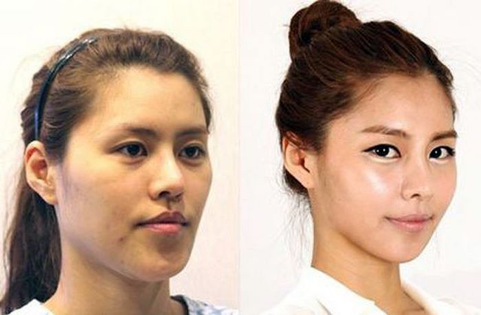 Plastic surgery before and after photos