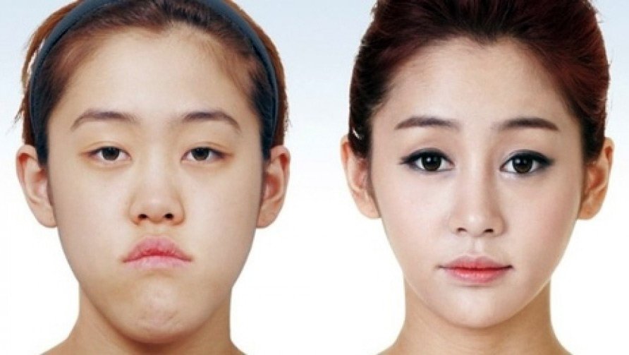 Plastic surgery before and after photos