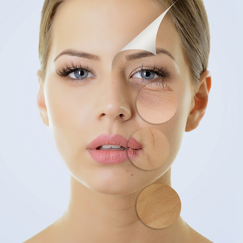 Simple rules for maintaining skin elasticity