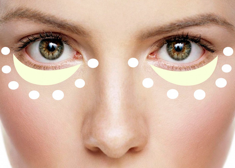 How to remove puffiness under the eyes at home