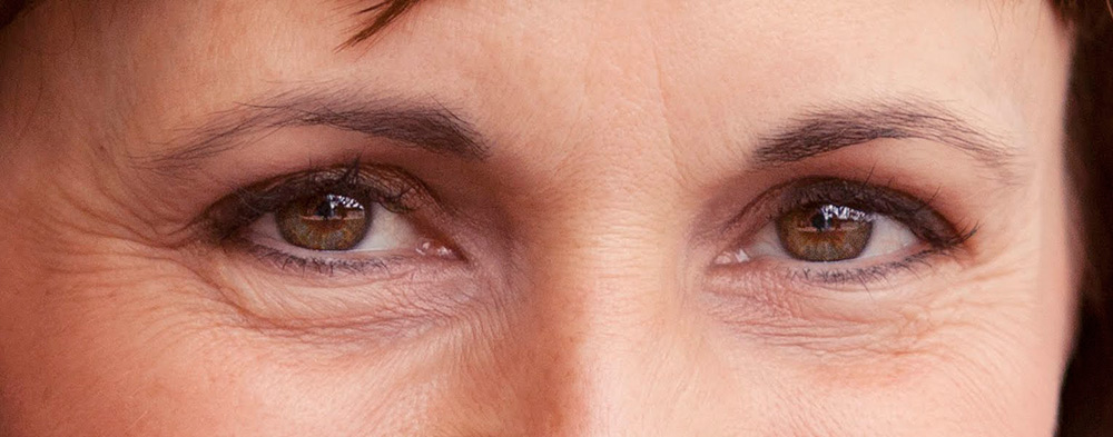 How to get rid of wrinkles around the eyes