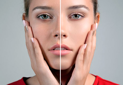 What is Enzyme Facial Peeling