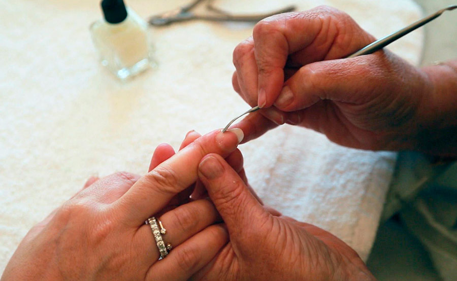 Dangers of manicure