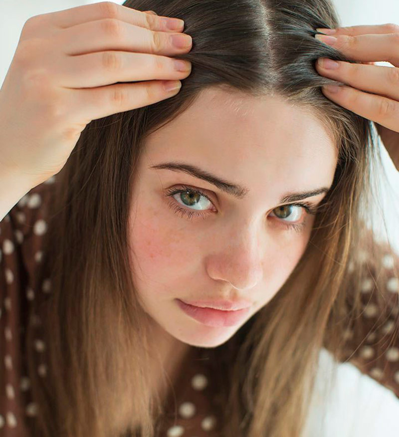 How to deal with early gray hair