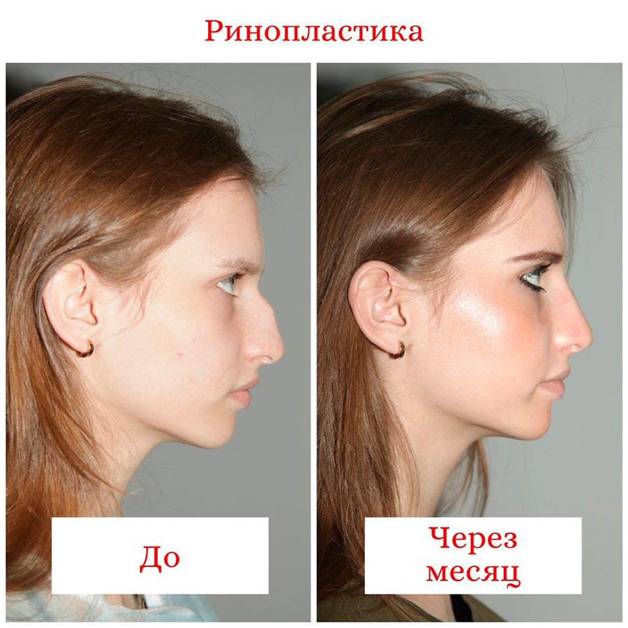 Plastic surgery in Russia, the real situation